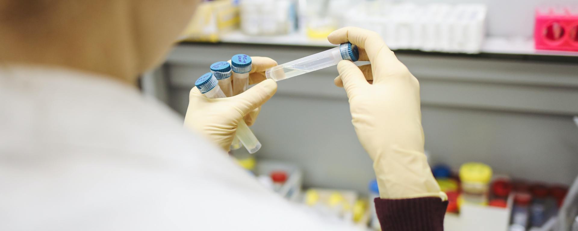 Globally, there is no improvement: WHO warns that the pandemic is getting worse in the world and has a "very significant" resurgence in Europe